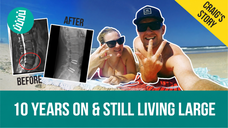 Craig at the beach after artificial disc replacement surgery in Germany